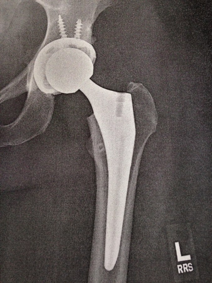 16FEFD3E-E112-4D48-9414-CB3737013251